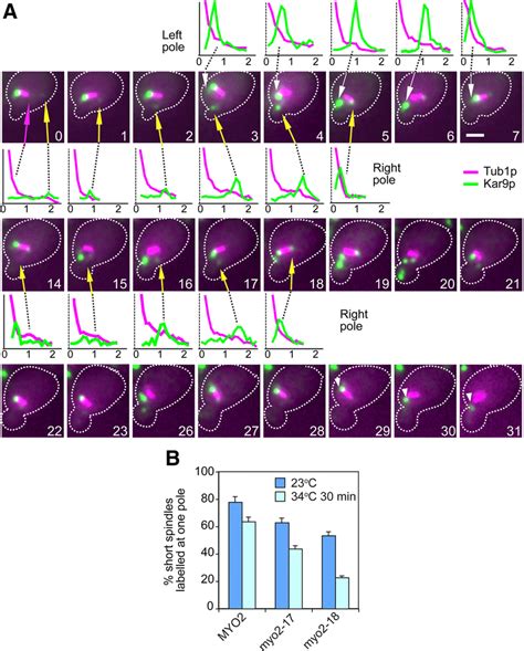 Kar9p Accumulation Bias May Be Enforced By Sustained Cycles Of Amt