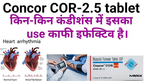 Concor Cor 2 5 Tablet Ke Kya Upyog Hai Fayde Hai Bisoprolol Fumarate