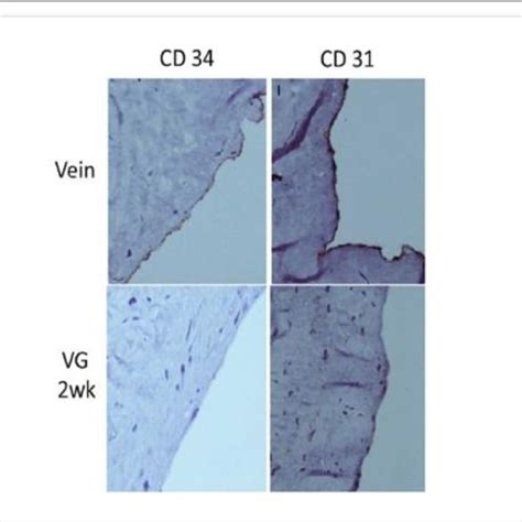 Immunohistochemical Staining Of CD34 And CD31 Expressions In The Human