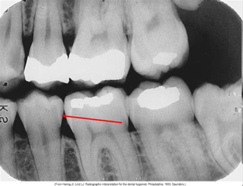 Radiology Exam Ch Radiology Image Exam Flashcards Quizlet