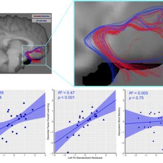 A Tractography Delineating The Right Uncinate Fasciculus Uf Red And