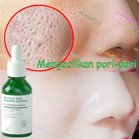 Jual Niacinamide Serum Salicylic Acid Serum Krim Jerawat Pengecil Pori