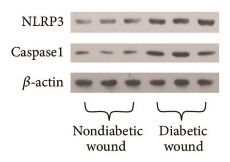 Mrna And Protein Expression Of Nlrp3 Caspase1 And Il 1β In Diabetic