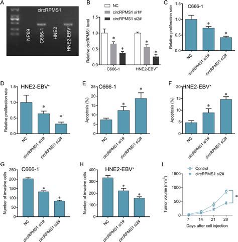 Silencing Circrpms1 Inhibited Npc Cell Proliferation Notes A Rt Pcr