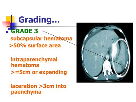 Retroperitoneal Hematoma Zones Approach Ppt Download