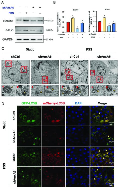 Knockdown Of AnxA6 Impairs FSS Induced Autophagy A B Western Blot