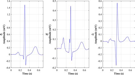 Figure 1 From Comparison Of Different Electrocardiography With