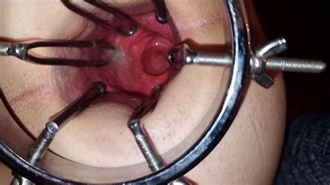 Deep View Into My Anal Tunnel Asshole Spreader Gay Porn A1 XHamster