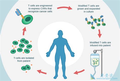 CAR T细胞治疗方法是具有划时代意义的癌症新疗法 康安途海外医疗