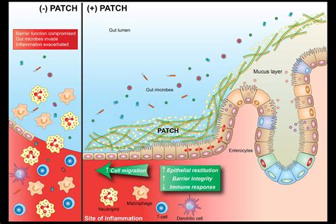 Engineered Probiotic Developed To Treat Multiple Sclerosis — Harvard Gazette