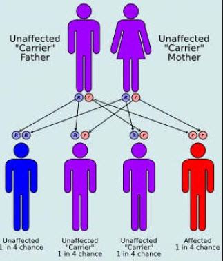 Gaucher Disease: Causes, Symptoms, And Treatments