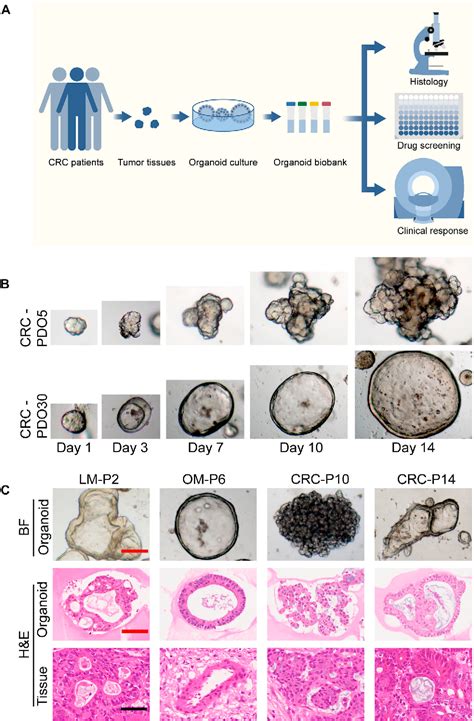 Figure From Patient Derived Organoids As A Platform For Drug