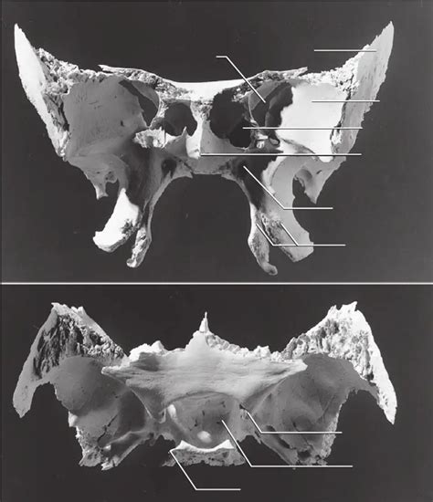 Sphenoid Anterior Superior Diagram Quizlet