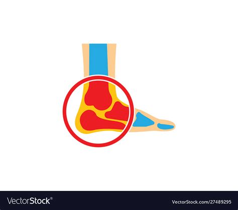 Foot Bone Logo Royalty Free Vector Image Vectorstock