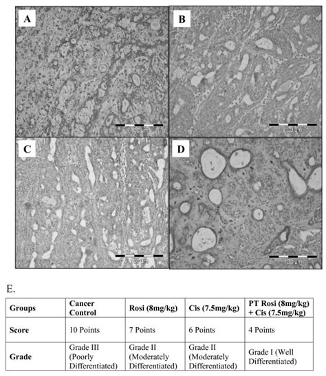 Effect Of Rosiglitazone Pretreatment On Mammary Tumour Histopathology