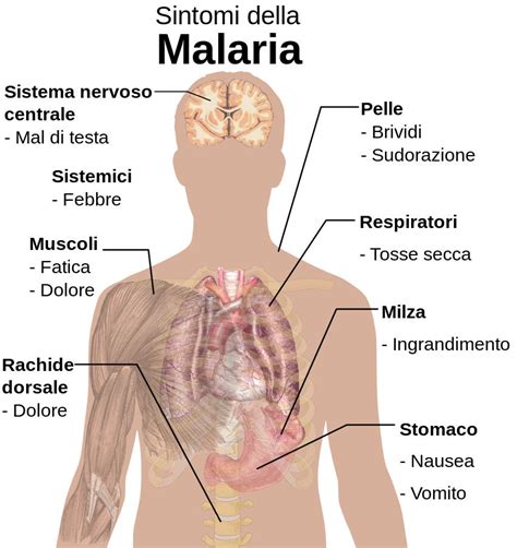 Malaria Sintomi Profilassi Vaccino E Contagio