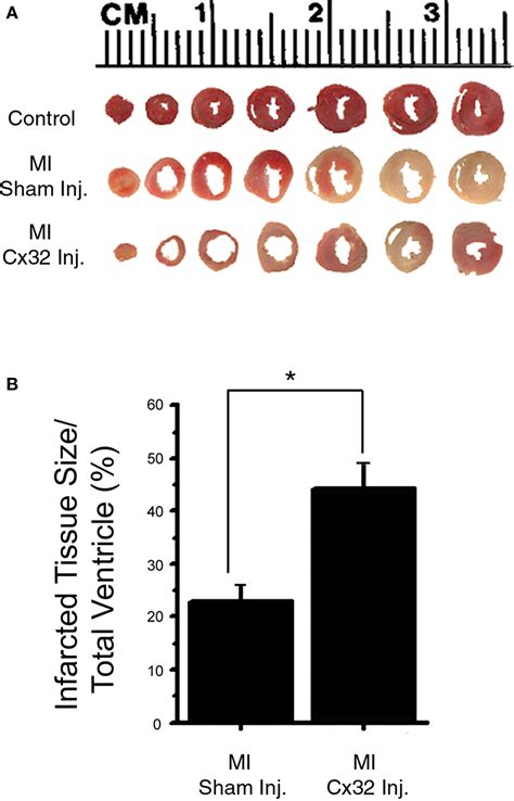 Frontiers Increased Cell Cell Coupling Increases Infarct Size And