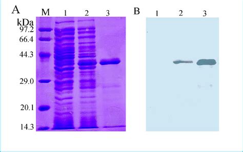 Sds Page And Western Blot Analysis Of The Expression And Purification