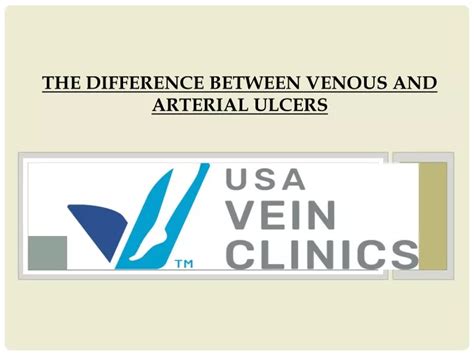 PPT The Difference Between Venous And Arterial Ulcers PowerPoint