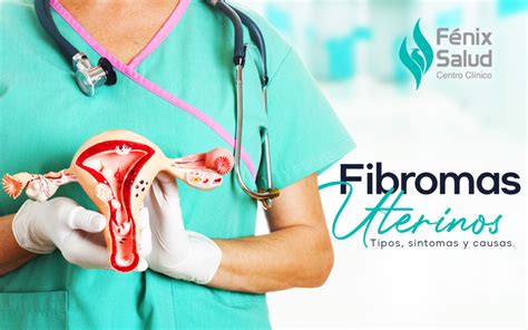 Fibromas Uterinos Tumores No Cancerosos Centro Clínico Fenix Salud