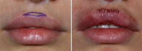 What Do Cupid Bow Lips Look Like | Lipstutorial.org