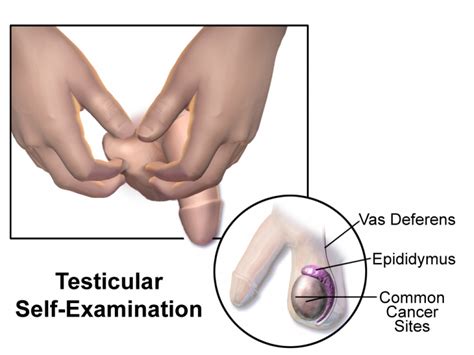 April Is Testicular Cancer Awareness Month—have You Checked Yourself