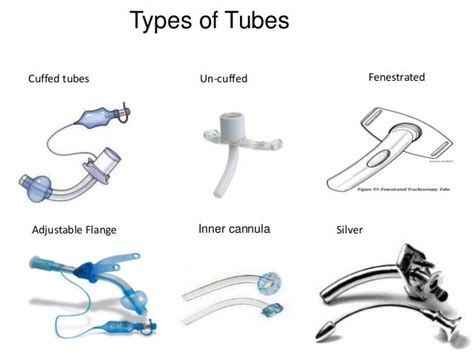 Types Of Tracheostomy