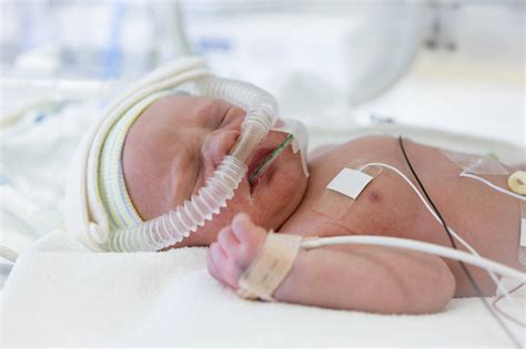 Nippv And High Level Pulmonary Support In Neonates Respiratory Therapy