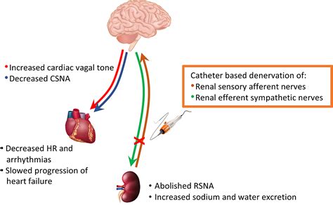 Renal Denervation In Resistant Hypertension A Review Of Off