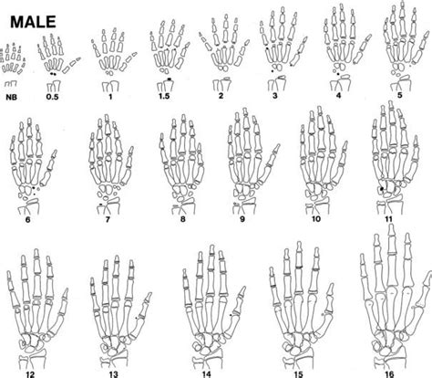 Somatic Growth And Maturation Oncohema Key