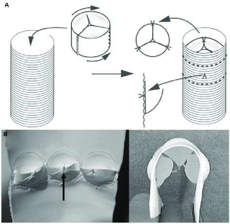 Operative Illustrations For Expanded Polytetrafluoroethylene Eptfe Download Scientific