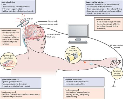 Neuromodulation in the restoration of function after spinal cord injury