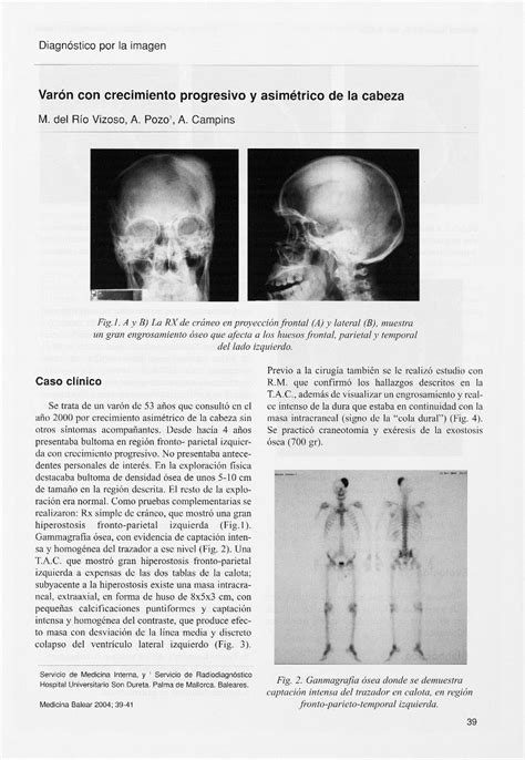 Pdf Var N Con Crecimiento Progresivo Y Asim Trico De La Cabeza De