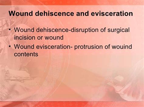 Concept On Surgery Postoperative