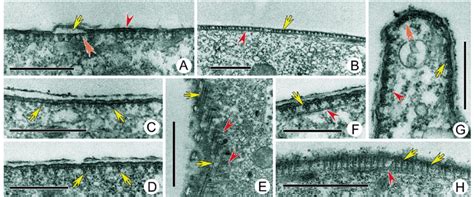 Transmission Electron Micrographs Of Cortex Of Diophrys Appendiculata