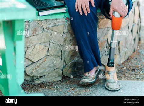View Of A Latina Woman S Prosthetic Leg Working On Her Computer In A School Playground She S