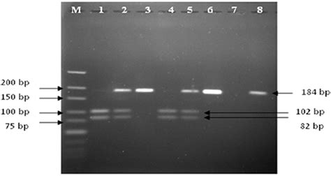 Gel Electrophoresis Of PCR RFLP Products For Representative Blood