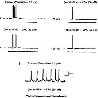 A Voltage Dependent Inhibitory Effect Of VPA On Epileptiform