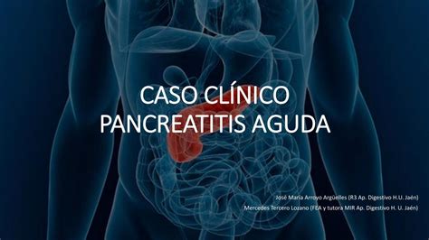 PDF CASO CLÍNICO PANCREATITIS AGUDA PDFSLIDE NET