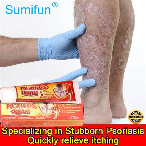 Sumifun Psoriasis Cream Eczema Ointment Antibacterial Ointment Skin