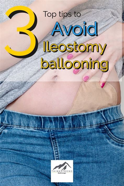 Ileostomy Ibd Crohns Disease Stoma Ostomy Artofit