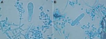 Trichophyton Mentagrophytes Introduction Classification History