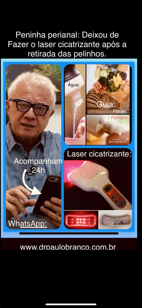 Pelinha ou plicoma perianal tratada erradamente – Dr. Paulo Branco