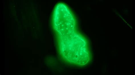 Acridine Orange Staining For Fluorescence First Attempt YouTube