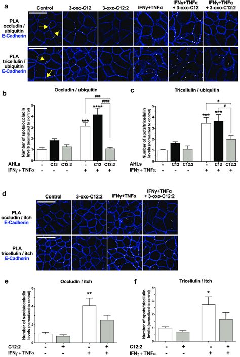 The 3 Oxo C12 2 Ahl Protects Occludin And Tricellulin From Download Scientific Diagram