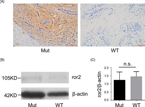 IHC And WB Results A IHC Results Of The Ror2 Expression In