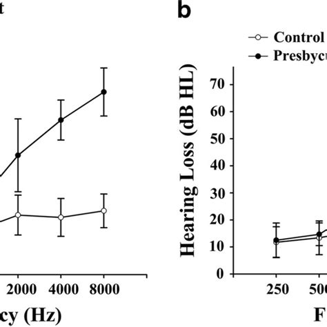 Mean Hearing Thresholds Of The Presbycusis And Control Groups In Left