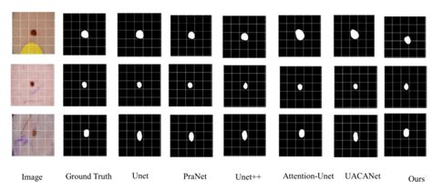 Model Segmentation Results In The Kvasir Seg Dataset Fig4 Shows The