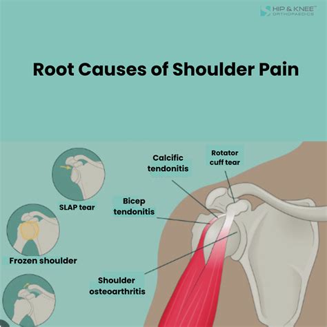 Shoulder Pain After Waking Up Causes And Solutions Hipandknee Sg