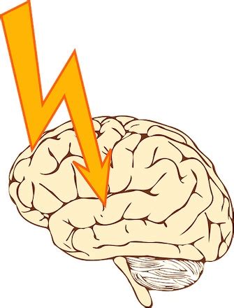 Atonic Seizure | Definition, Causes & Treatment | Study.com